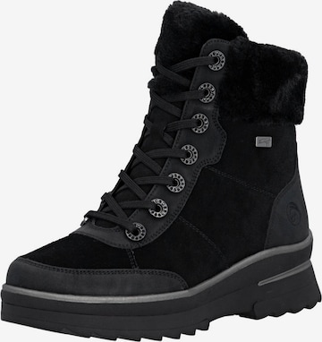 REMONTEGležnjače na vezanje - crna boja: prednji dio