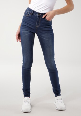 KangaROOS Skinny Jeans in Blue: front