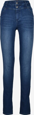 Buena Vista Slimfit Jeans in Blau: predná strana
