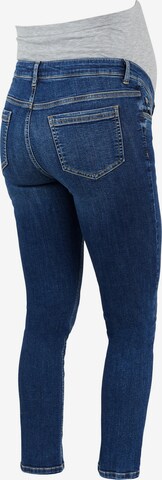 MAMALICIOUS Slimfit Jeans 'Hampshire' in Blauw