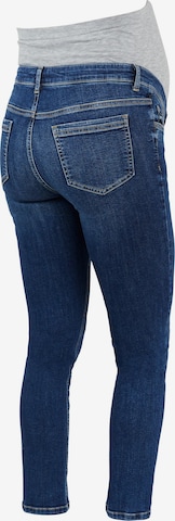 MAMALICIOUS Slim fit Jeans 'Hampshire' in Blue