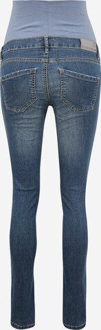 Supermom Skinny Jeans in Blau