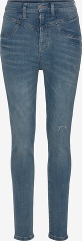 LASCANA Skinny Jeans in Blauw: voorkant