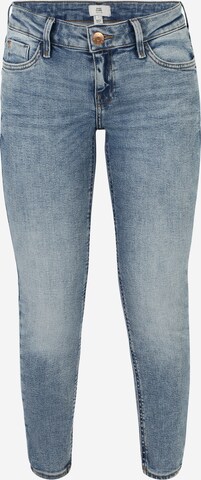 River Island Petite Skinny Τζιν 'AMELIE ARTHUR' σε μπλε: μπροστά