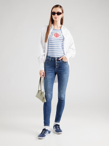 ONLY Skinny Jeans 'ONLWINNIE' in Blauw