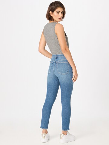 Skinny Jeans de la Madewell pe albastru