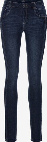 ARIZONA Skinny Jeans in Blue: front