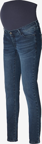 Noppies Skinny Jeans 'Avi' in Blauw: voorkant