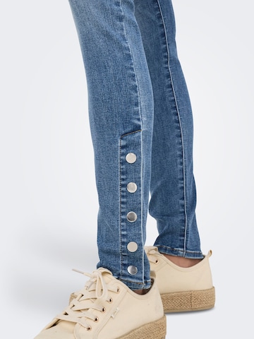 Slimfit Jeans 'ONLWINNIE' di ONLY in blu
