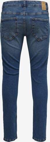 Only & Sons Skinny Jeans 'Loom' in Blau