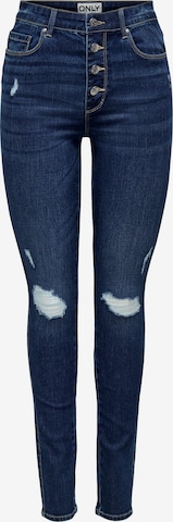 Jeans 'JOSIE' di ONLY in blu: frontale