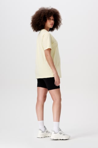 Noppies - Camiseta 'Ifke' en amarillo