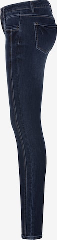 ARIZONA Skinny Jeans in Blue