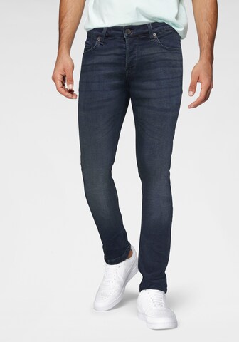 Only & Sons Skinny Jeans 'Loom' in Blue: front