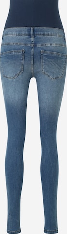 Skinny Jeans 'TANYA' di Vero Moda Maternity in blu