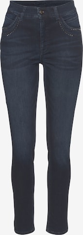 MAC Skinny Jeans in Blau: predná strana