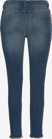 LASCANA Skinny Jeans in Blau