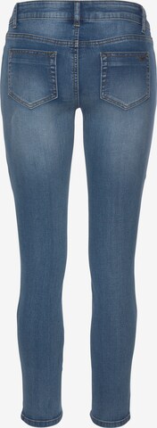 ARIZONA Skinny Jeans in Blau