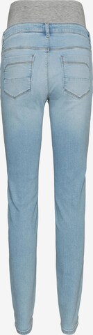 MAMALICIOUS Slimfit Jeans 'SAVANNA' i blå