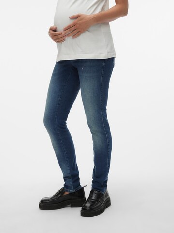 MAMALICIOUS Slimfit Jeans 'Akosta' i blå: framsida