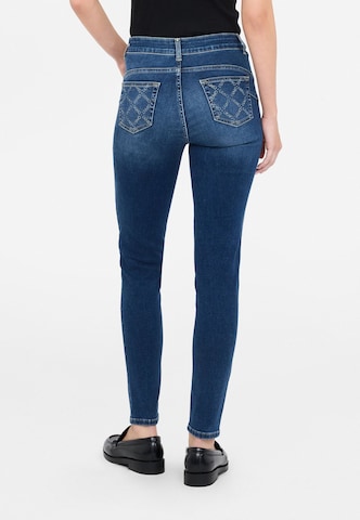 Liu Jo - Skinny Vaquero en azul