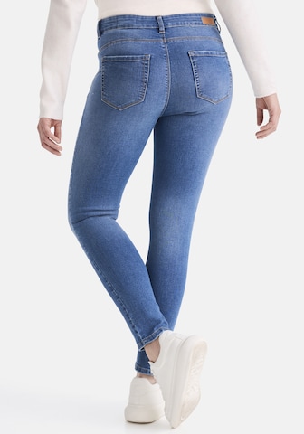 Skinny Jean 'Rio' STOOKER WOMEN en bleu