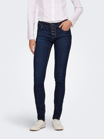 zils ONLY Šaurs Džinsi 'ONLRAIN': no priekšpuses