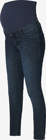 Supermom Skinny Jeans 'Austin' in Blue: front