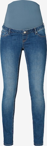 Noppies Skinny Jeans ' Avi ' in Blauw: voorkant