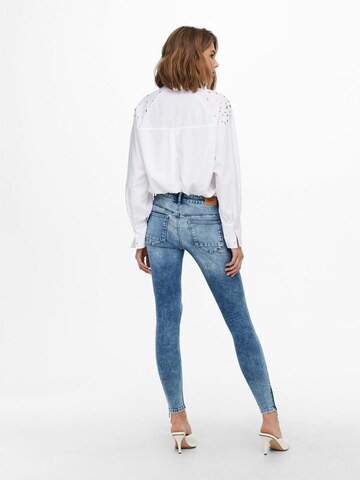 ONLY Skinny Jeans 'Kendell' i blå