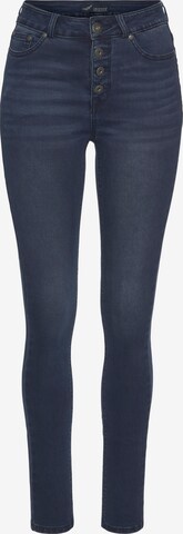 ARIZONA Skinny Jeans in Blau: predná strana