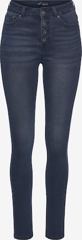 ARIZONA Skinny Jeans in Blue: front