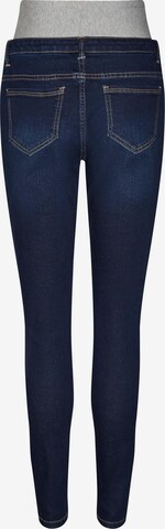 Vero Moda Maternity Skinny Jeansy 'Zia' w kolorze niebieski